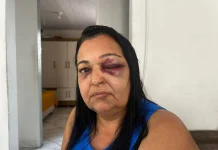 Mulher atropelada na faixa de pedestres em Colatina fala sobre o acidente